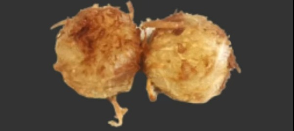 182. Cocosbällchen